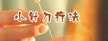 腱鞘炎疗法