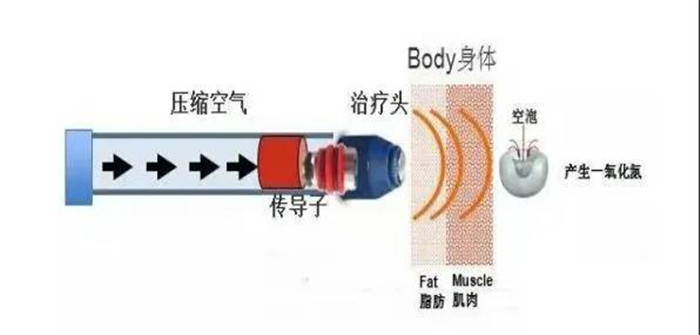 【康复知识小课堂（七）】体外冲击波的临床应用4.jpg