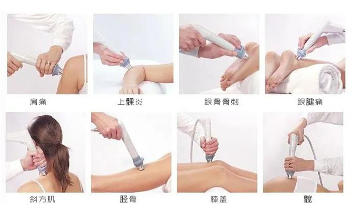 体外冲击波的临床应用1.jpg