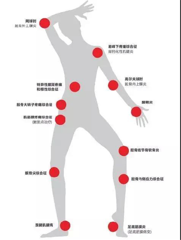 体外冲击波的临床应用2.jpg